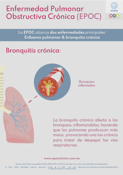 Bonquitis crónica
