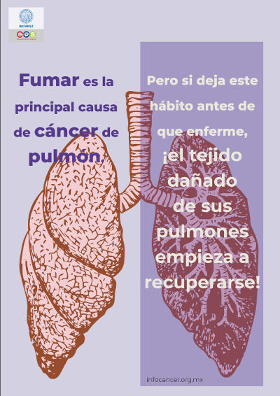 Fumar es la principal causa de cáncer de pulmón