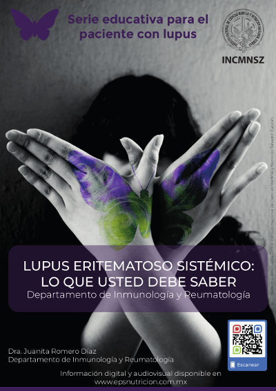 Lupus eritematoso sistémico: Lo que usted debe saber