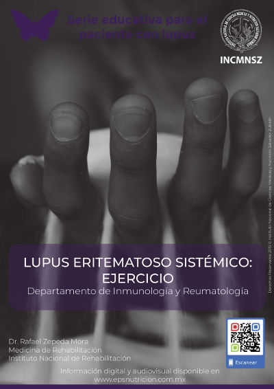 Lupus eritematoso sistémico: Ejercicio