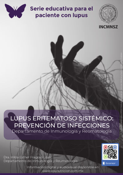 Lupus eritematoso sistémico: Prevención de infecciones